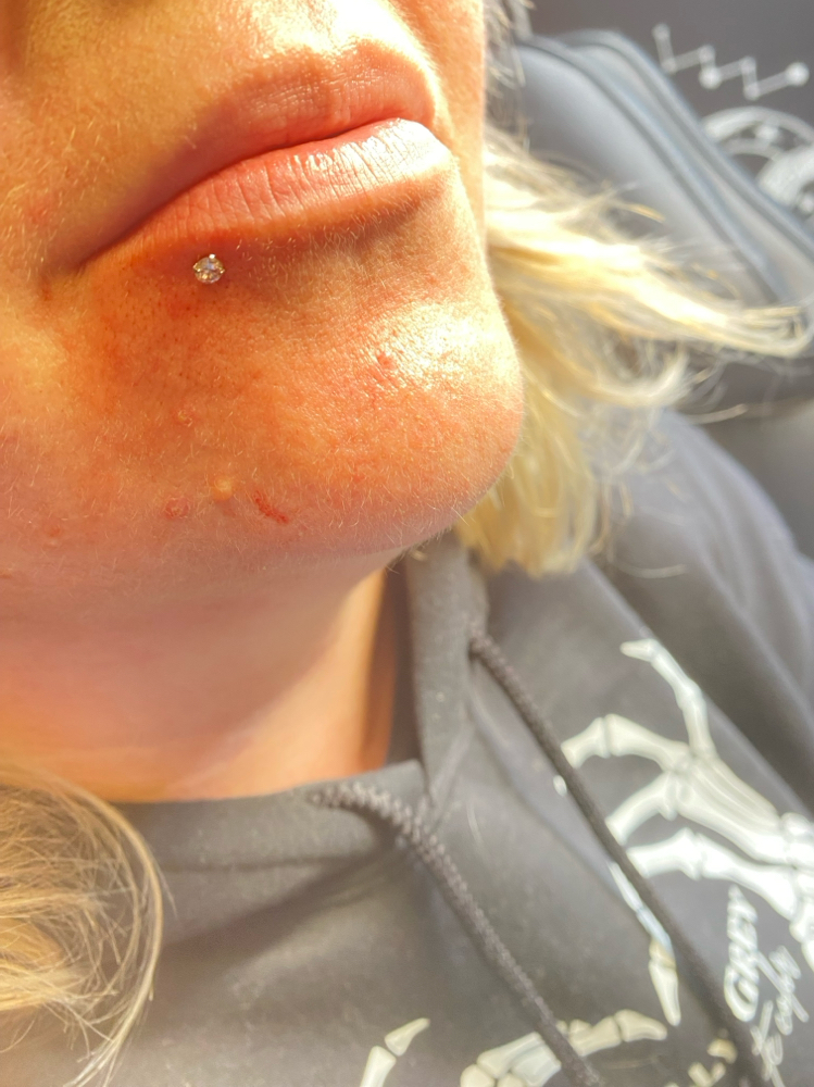 Lip Piercing