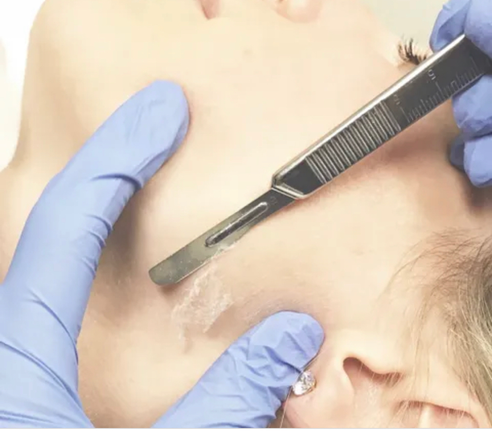 Dermaplaning Add On at Rachael Mixon in Willow Spring, NC