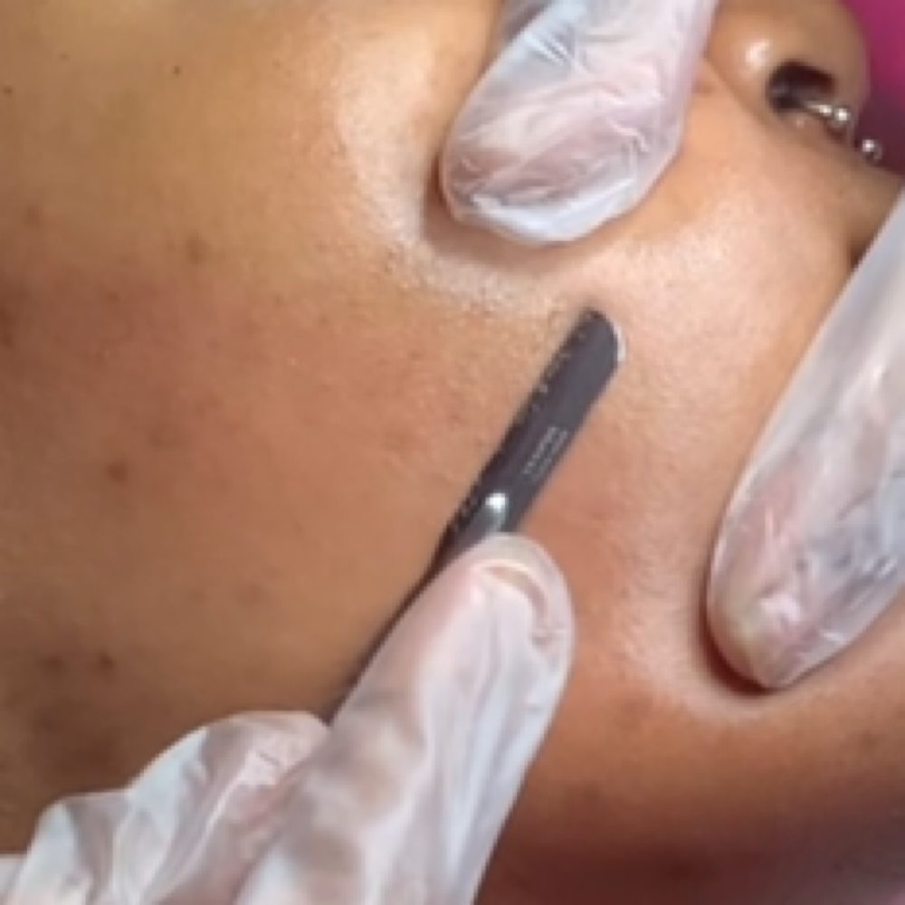 Dermaplane Like A Lady at The Beauty Palace ATL in Dunwoody, GA
