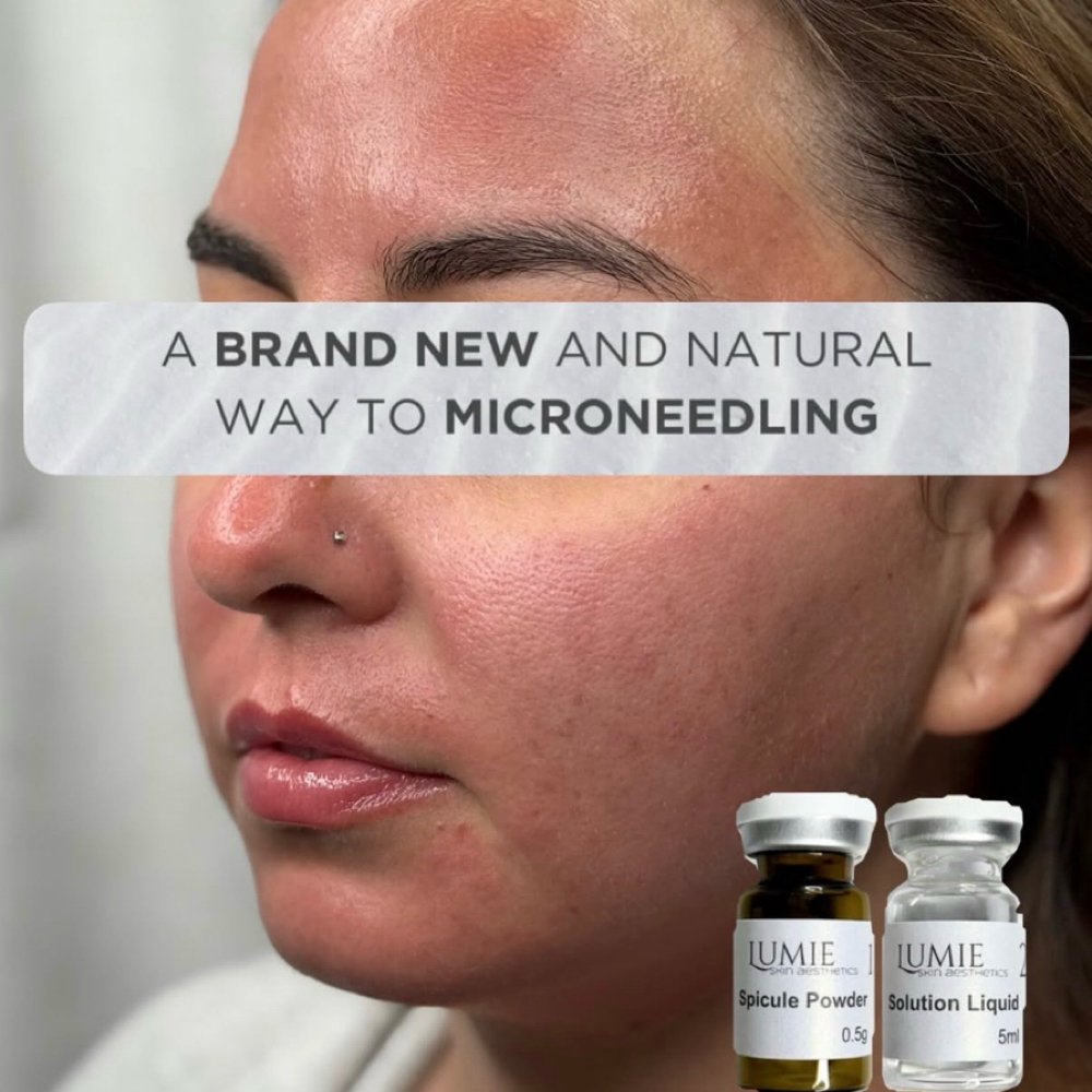 Bio Microneedling at MM Esthetics in Buena Park, CA