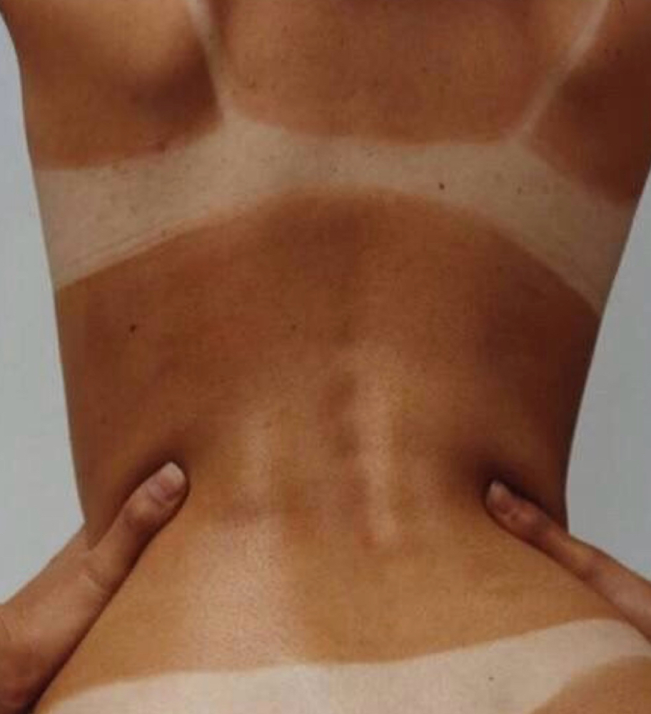SPRAY TANS