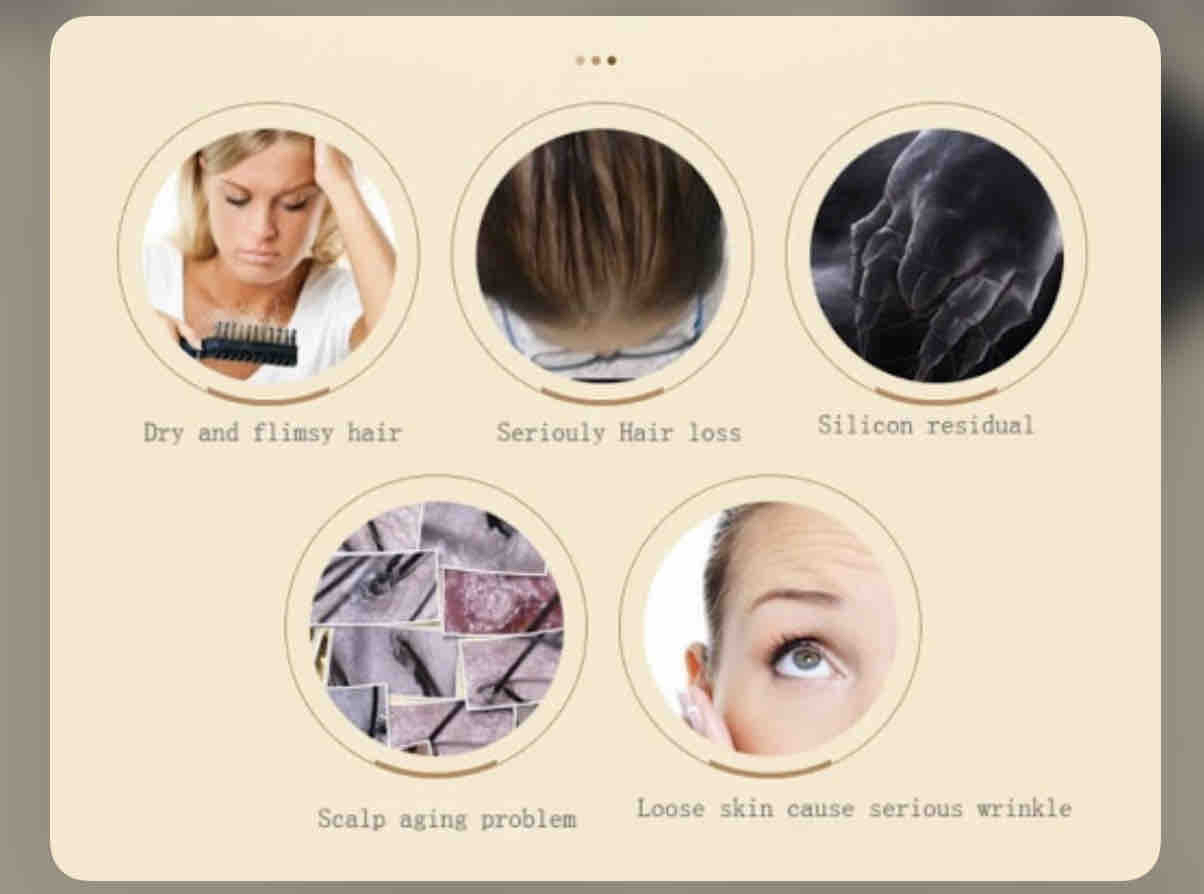 Scalp Treatment