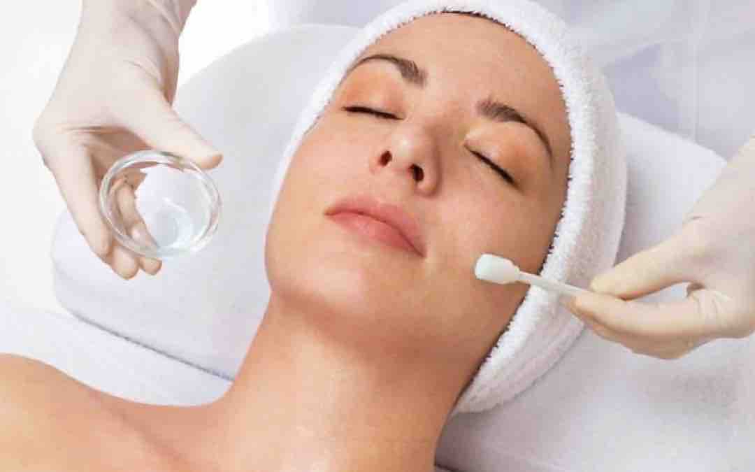 Chemical Peel