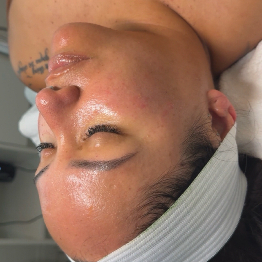 Custom Lux Facial Tier 2 at Karla Espinoza in Downey, CA