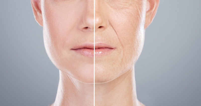 Wrinkle Lift Peel
