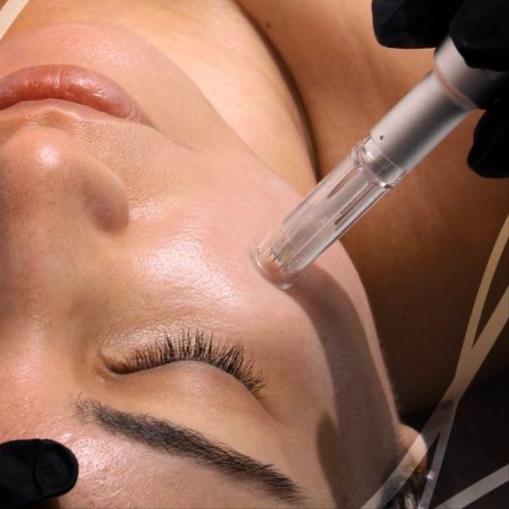 The Nano Infusion + Peel Facial at The Glo Haus Atlanta in Atlanta, GA