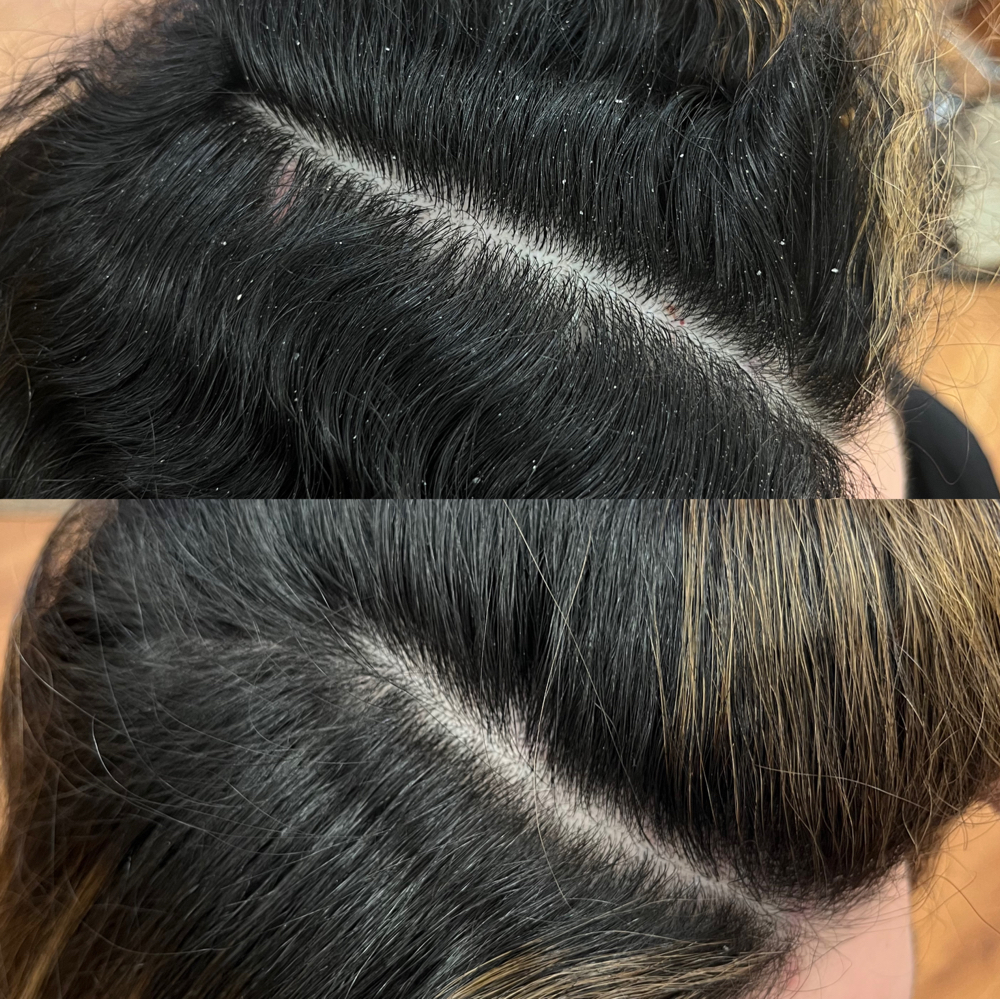 Scalp Therapy Session