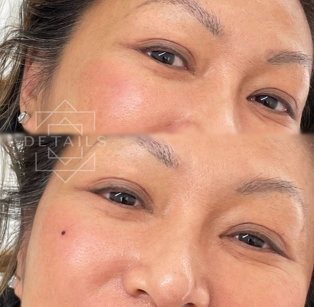 Beauty Marks +12