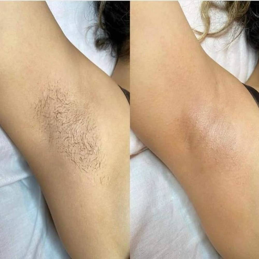 Underarms at The Lash & Wax Studio 🩷 in Pueblo West, CO