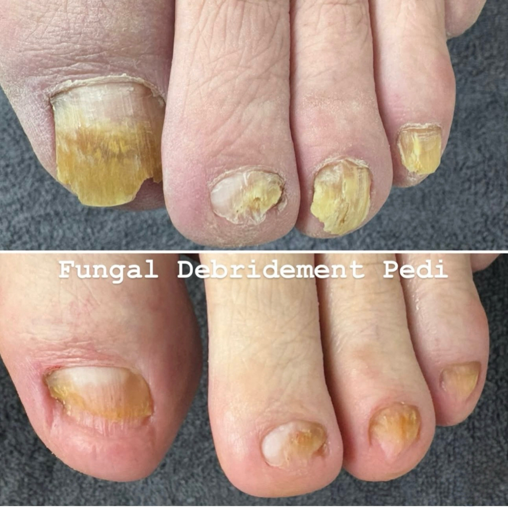 Men's Fungal Pedicure at Southern Oregon PEDICURE CLINIC in Medford, OR