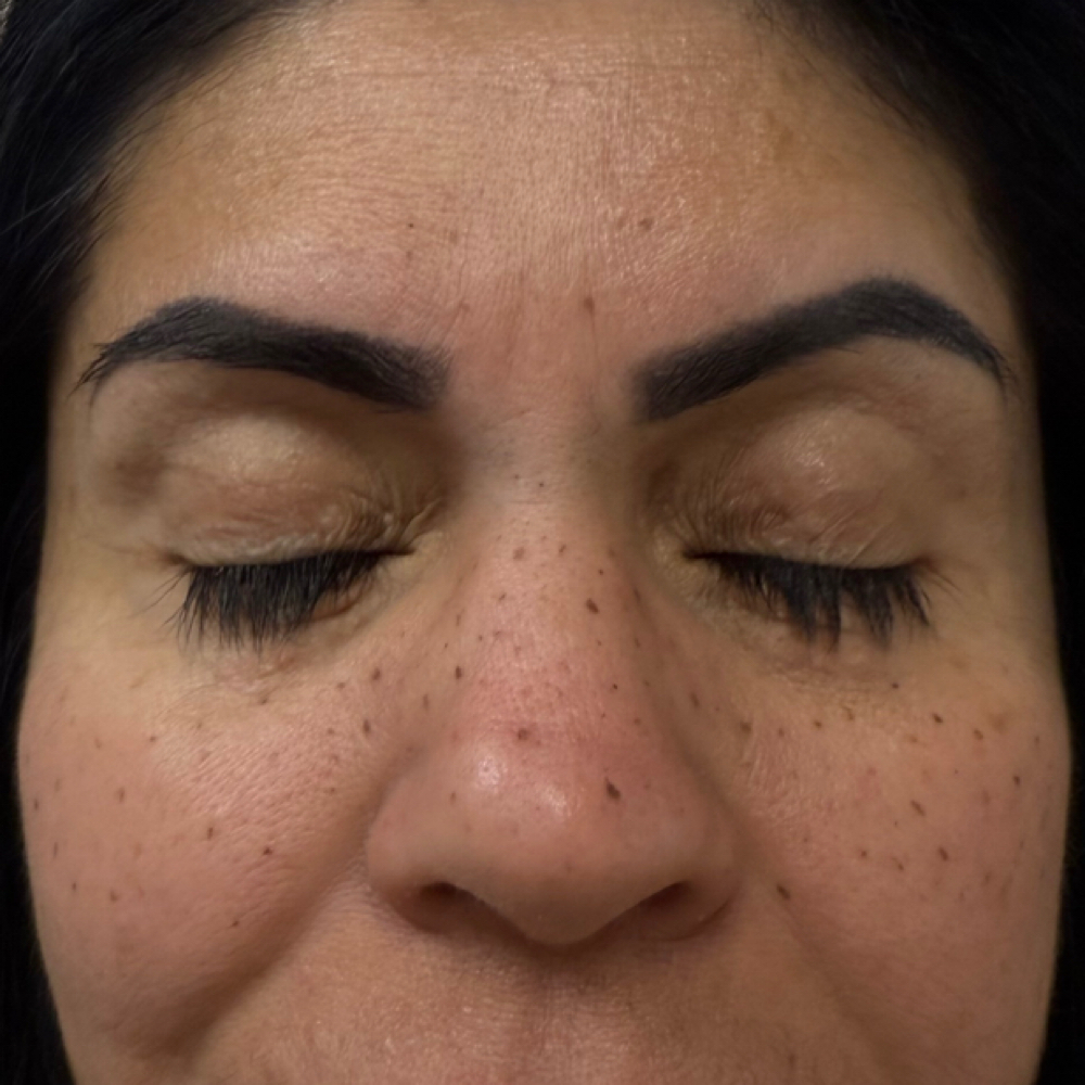 Permanent Freckles at Artistry by Aubrie in Las Cruces, NM