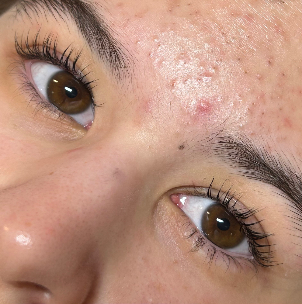 Lash Lift