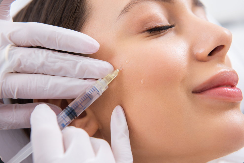 Cheek Filler