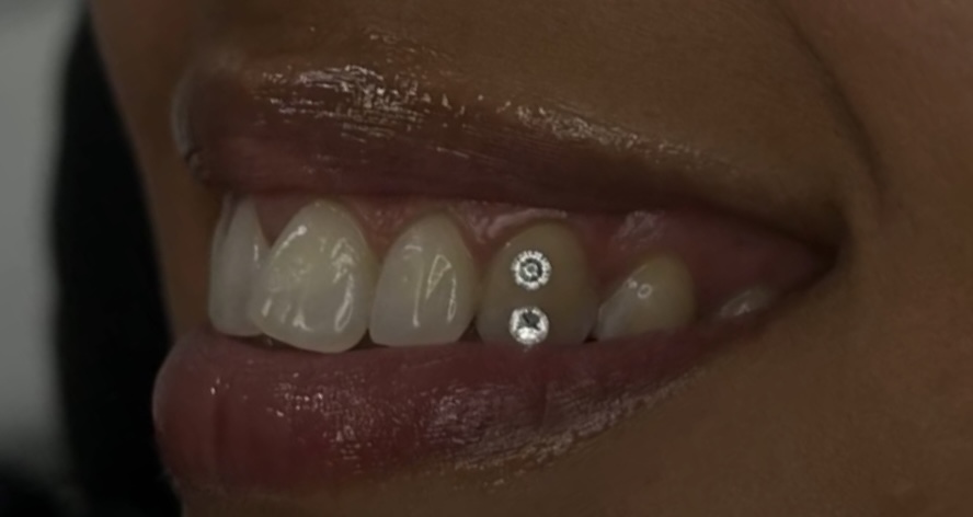 2 Swarovski Tooth Gem