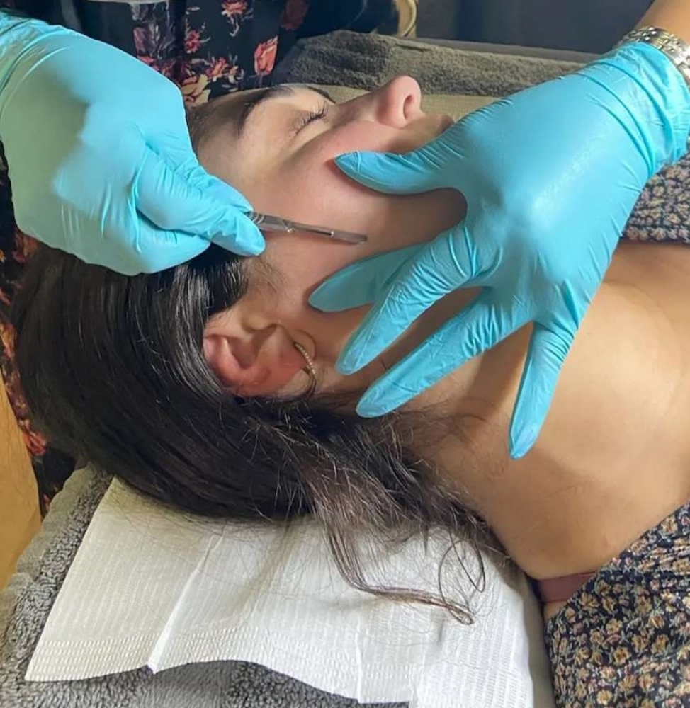 Dermaplaning