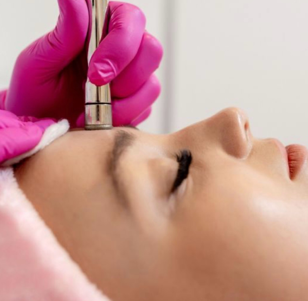 Microdermabrasion Facial