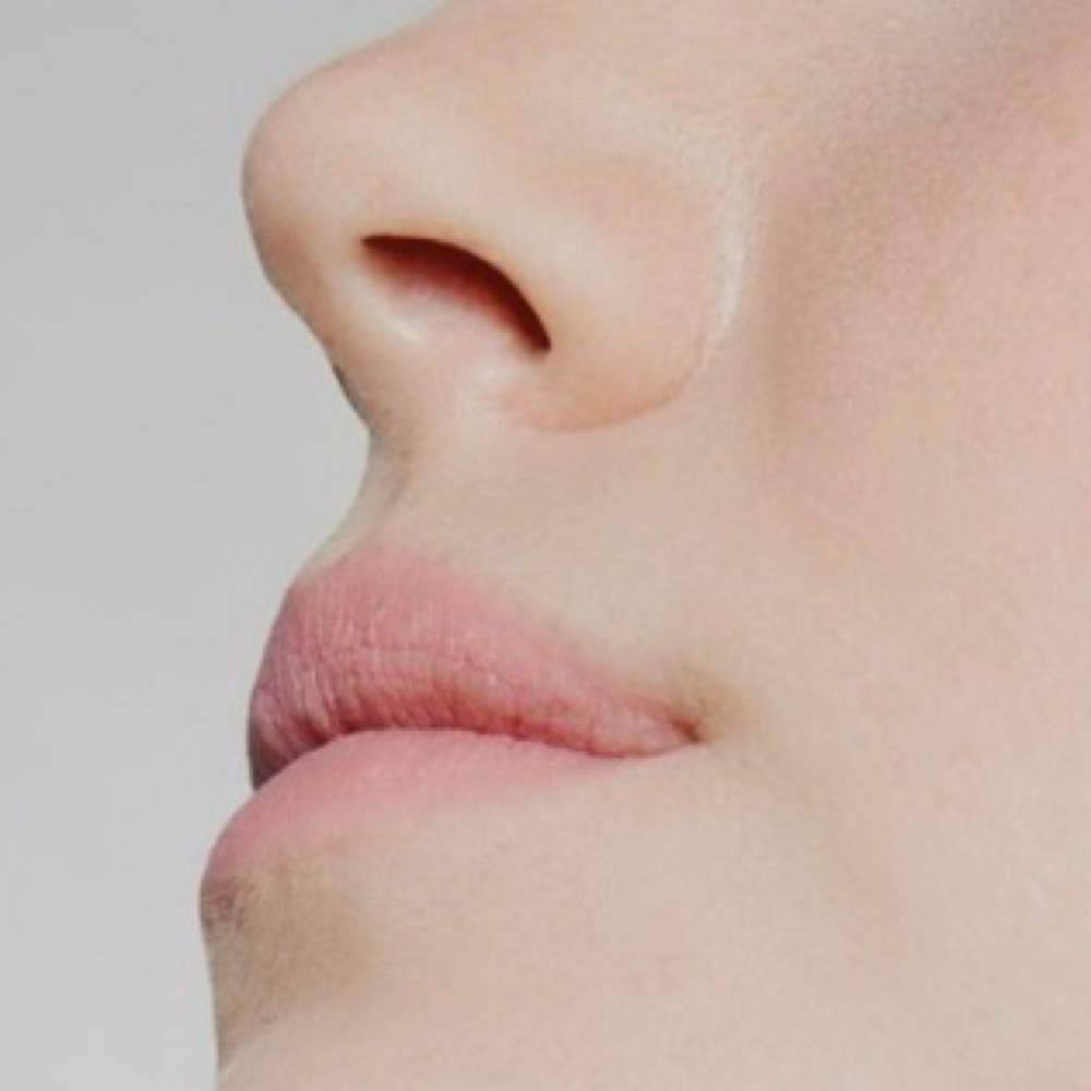 Nose at Imperial Esthetics in Raleigh, NC