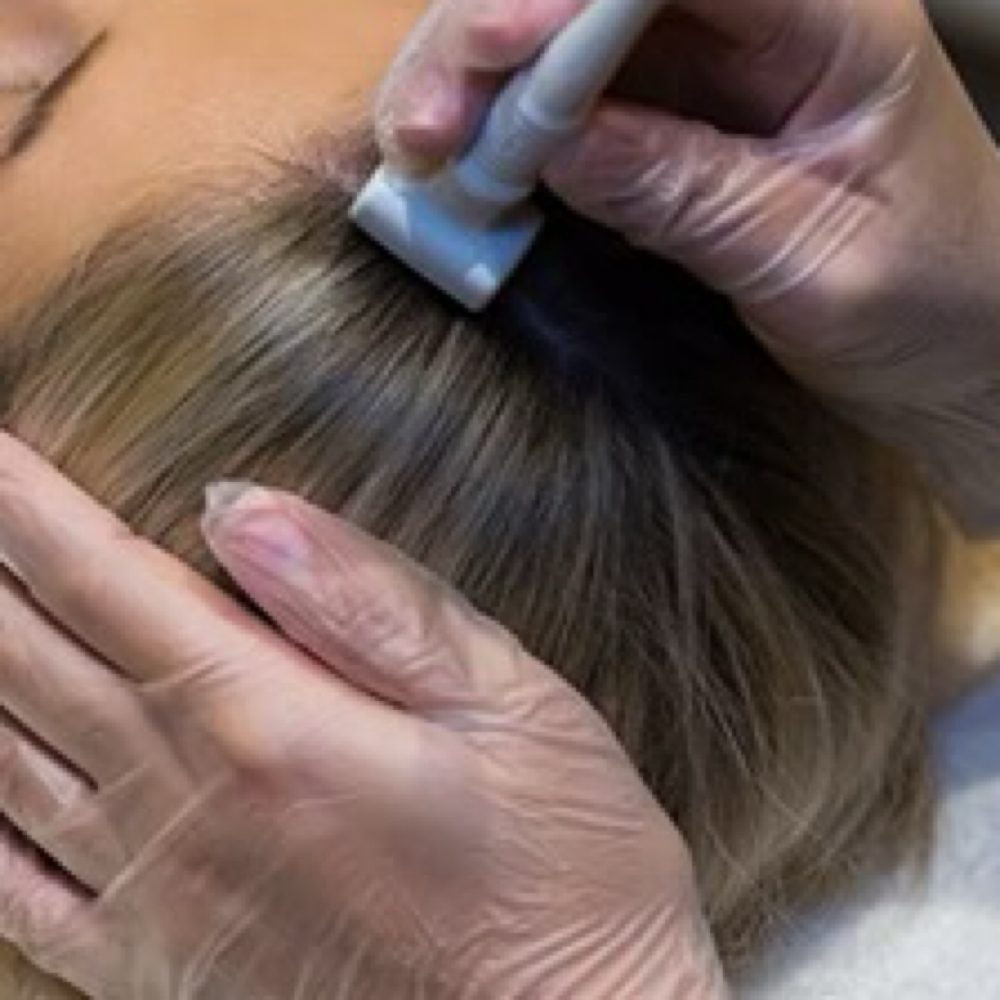 Strand Revival DermaTherapy at Lux tHAIRapy by ThickVixen in District Heights, MD