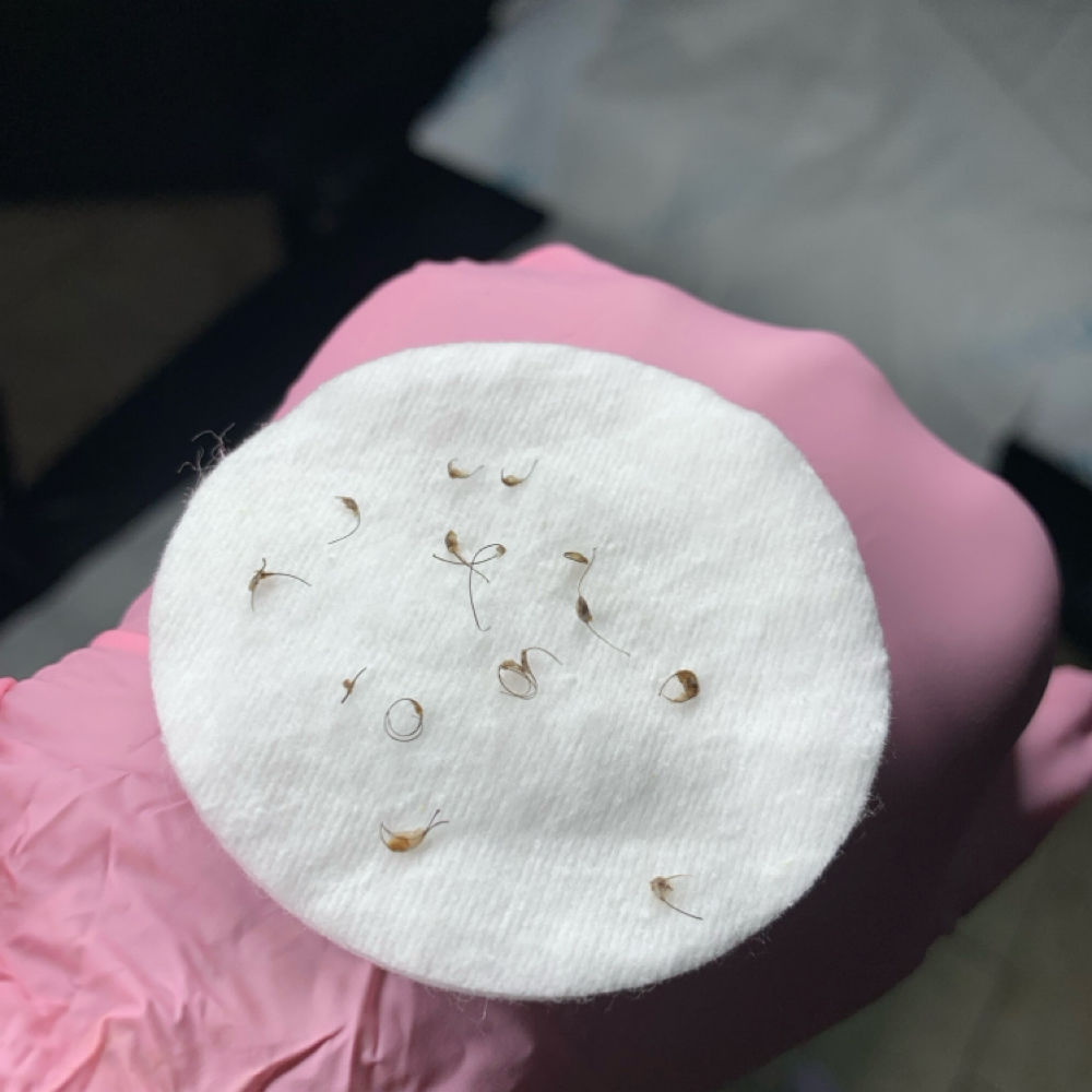 Brazilian Wax W/ Extractions