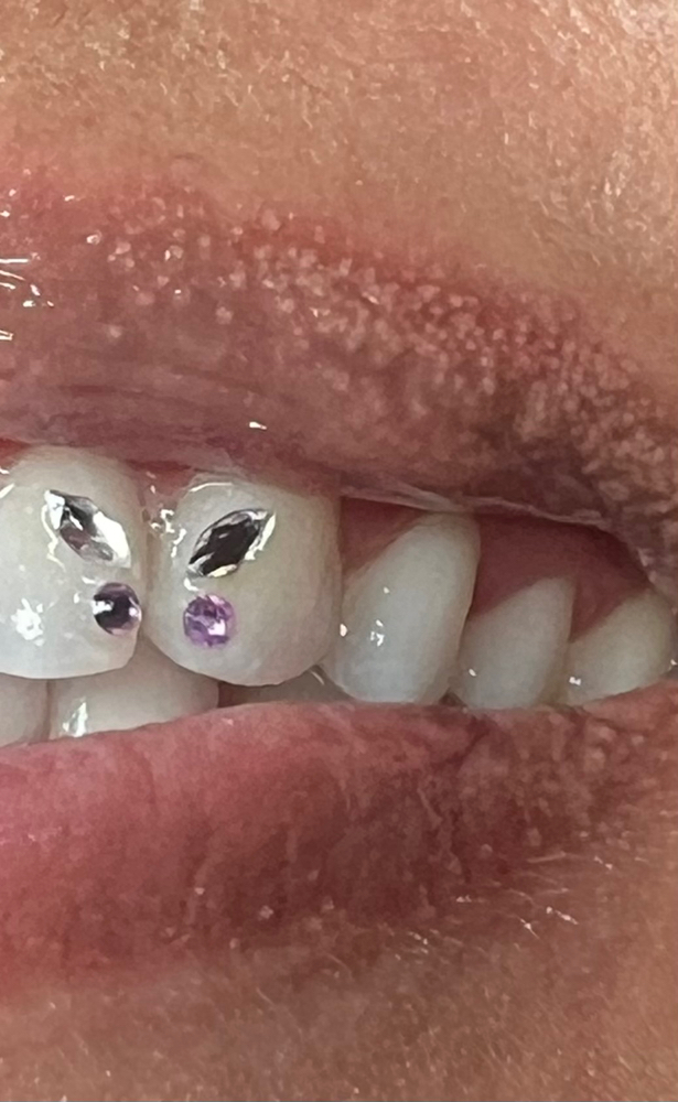 Butterfly Design π¦