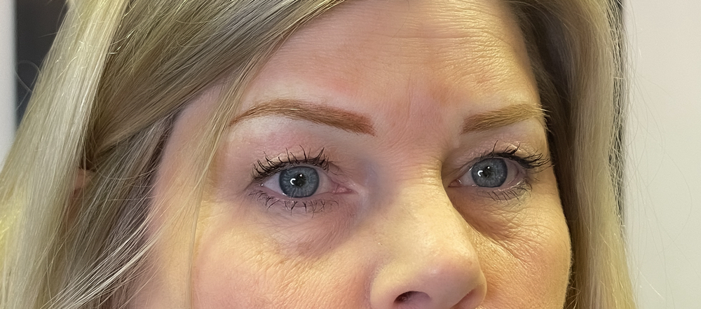 6-12 Month Touch Up