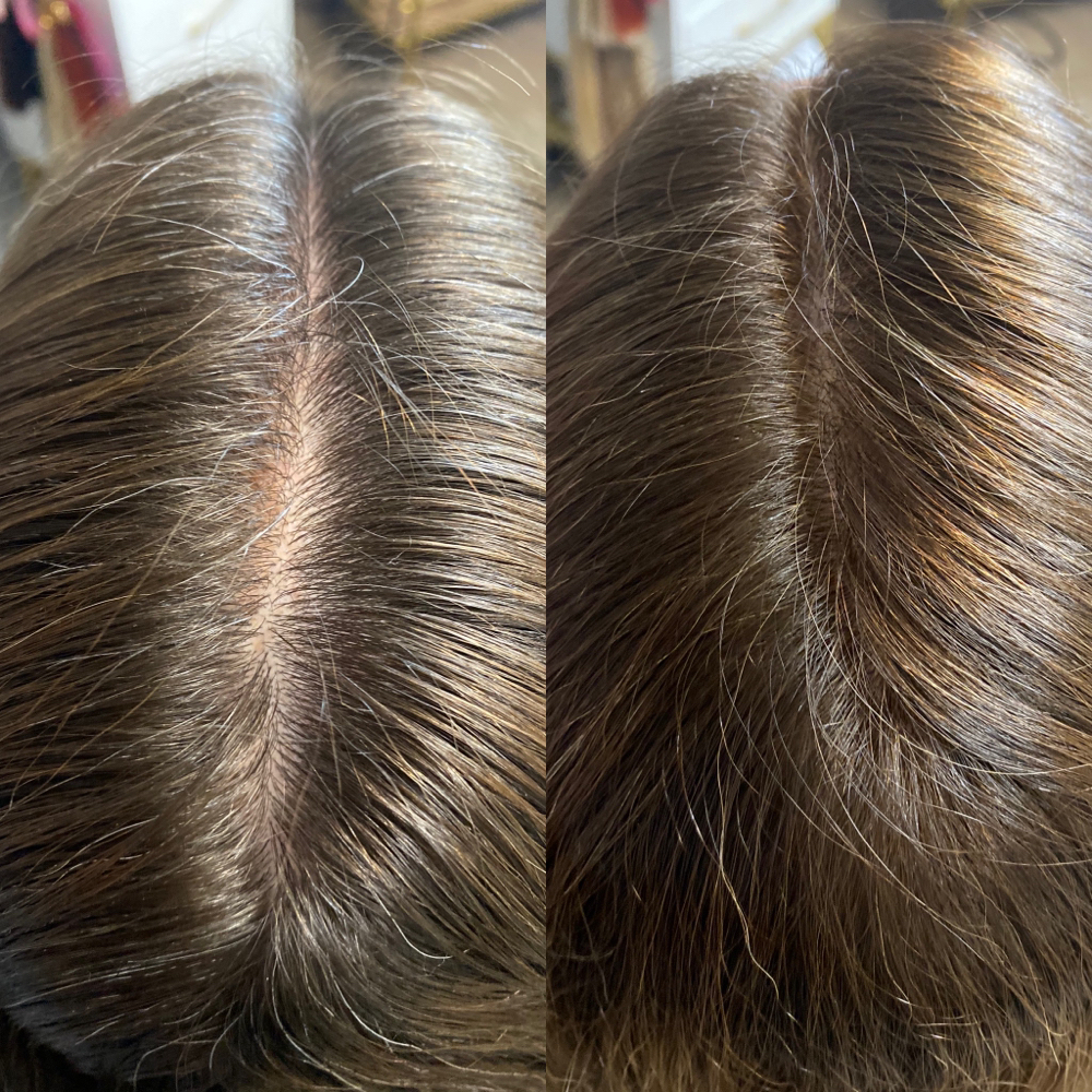 Root Retouch