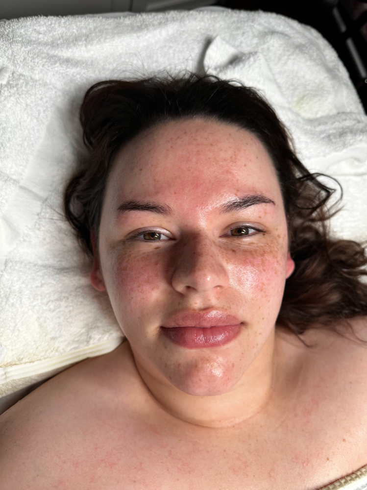 Lush Hydration Facial
