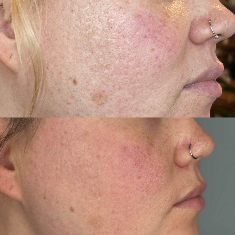 Aurora Glow Skin Infusion