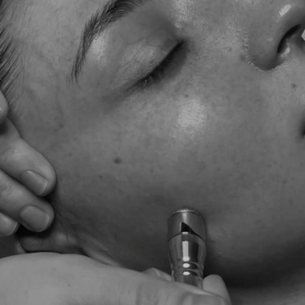 Microdermabrasion + Facial at BÄRESOUL in Mechanicsburg, PA