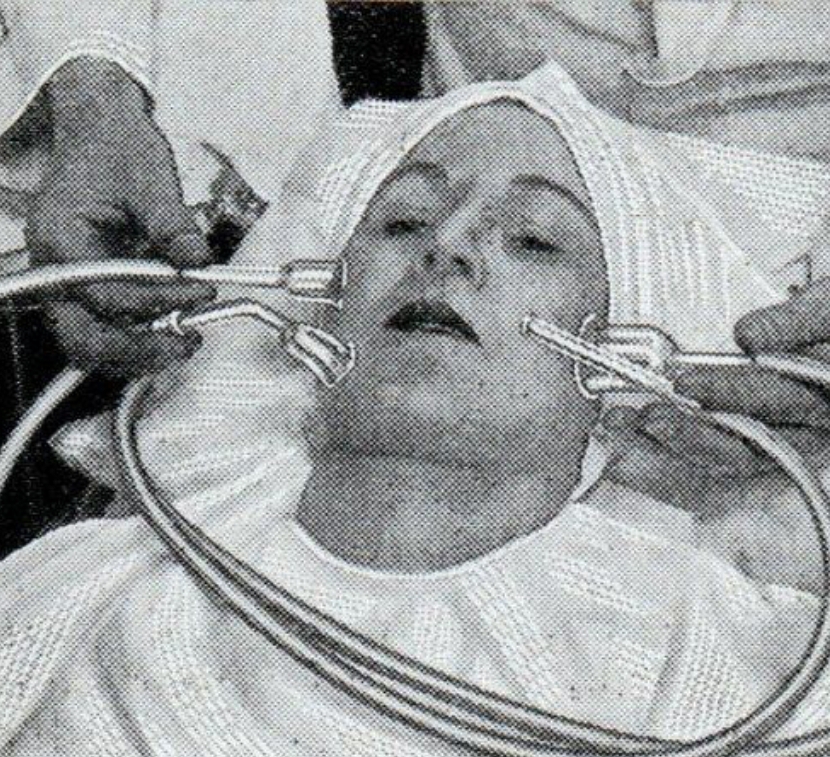 Nano Needling