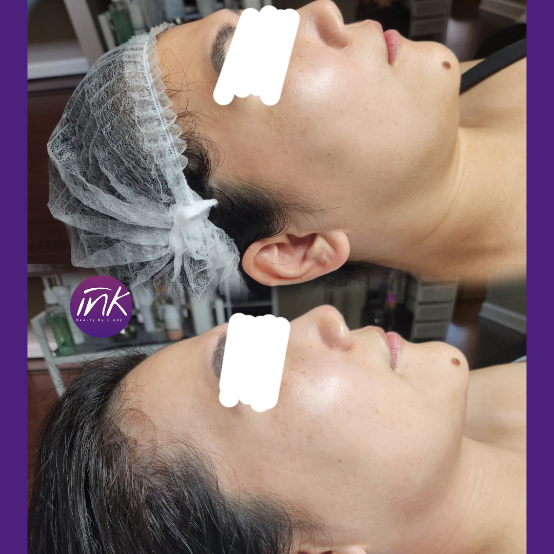 60 min Signature Facial at I.S Beauty Studio in Cumming, GA