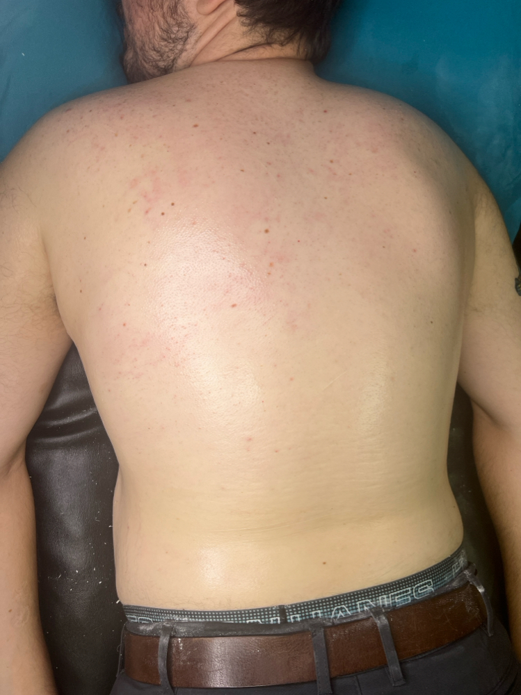 Male Back Wax + Shoulder Wax