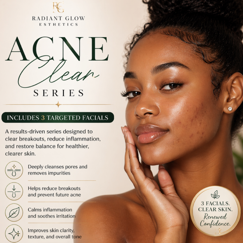 Acne Clear Series at Radiant Glow Esthetics in Dallas, TX