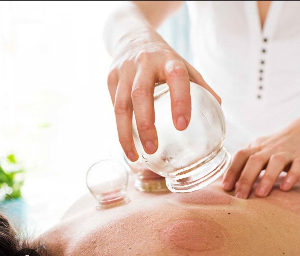 Medical Cupping Add On