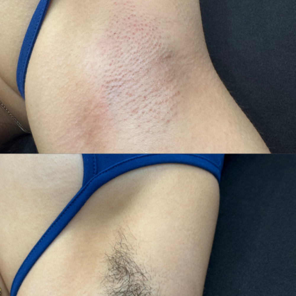 Under Arm Waxing at One Stop Beauty Studio in Bakersfield, CA