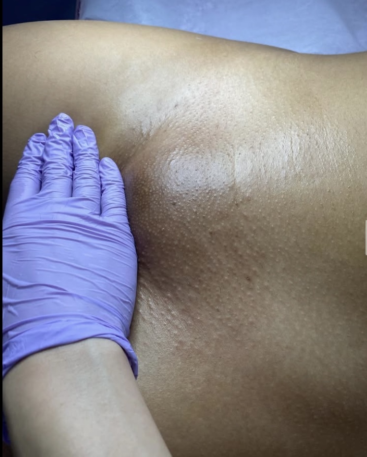 Brazilian Wax