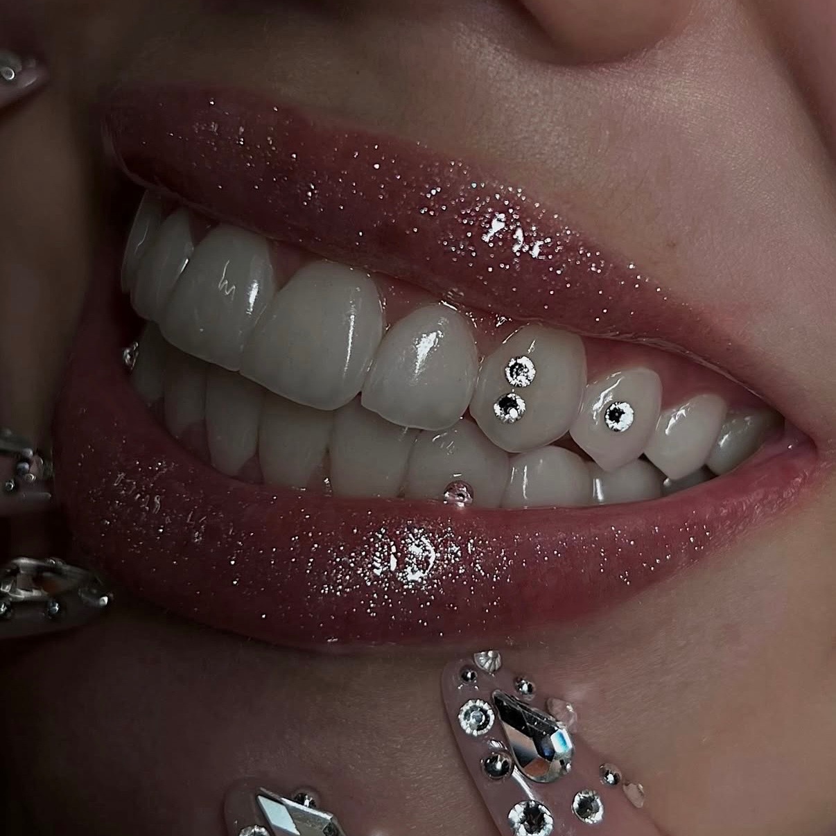 Tooth Gems at Beautique J in Dorchester, MA