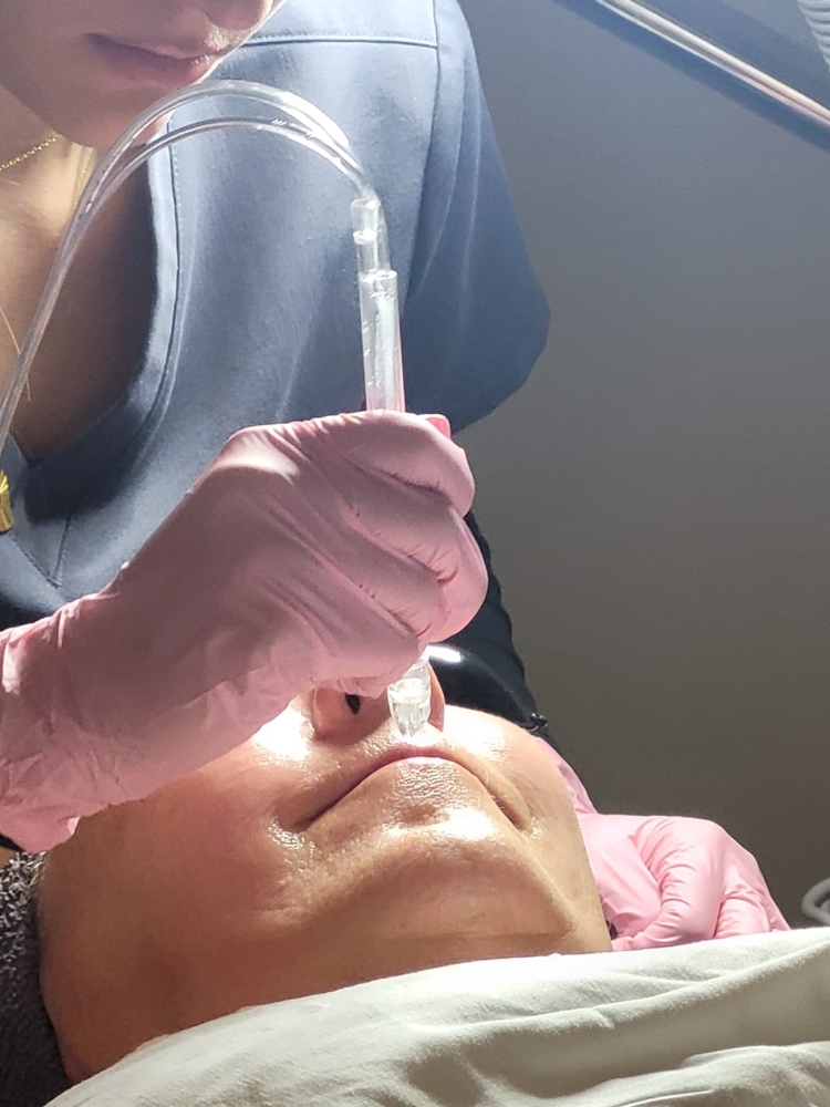 Hydro Oxyjet Peel Treatment