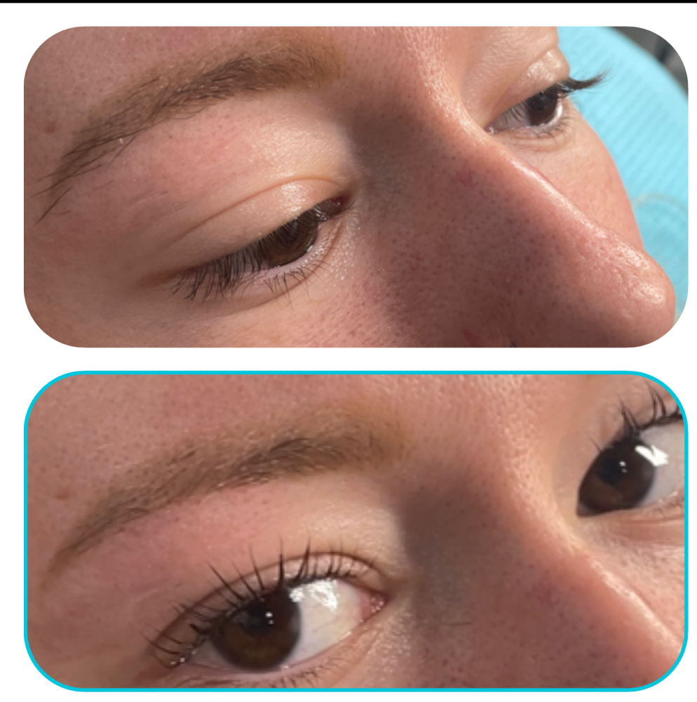 Lash Lift