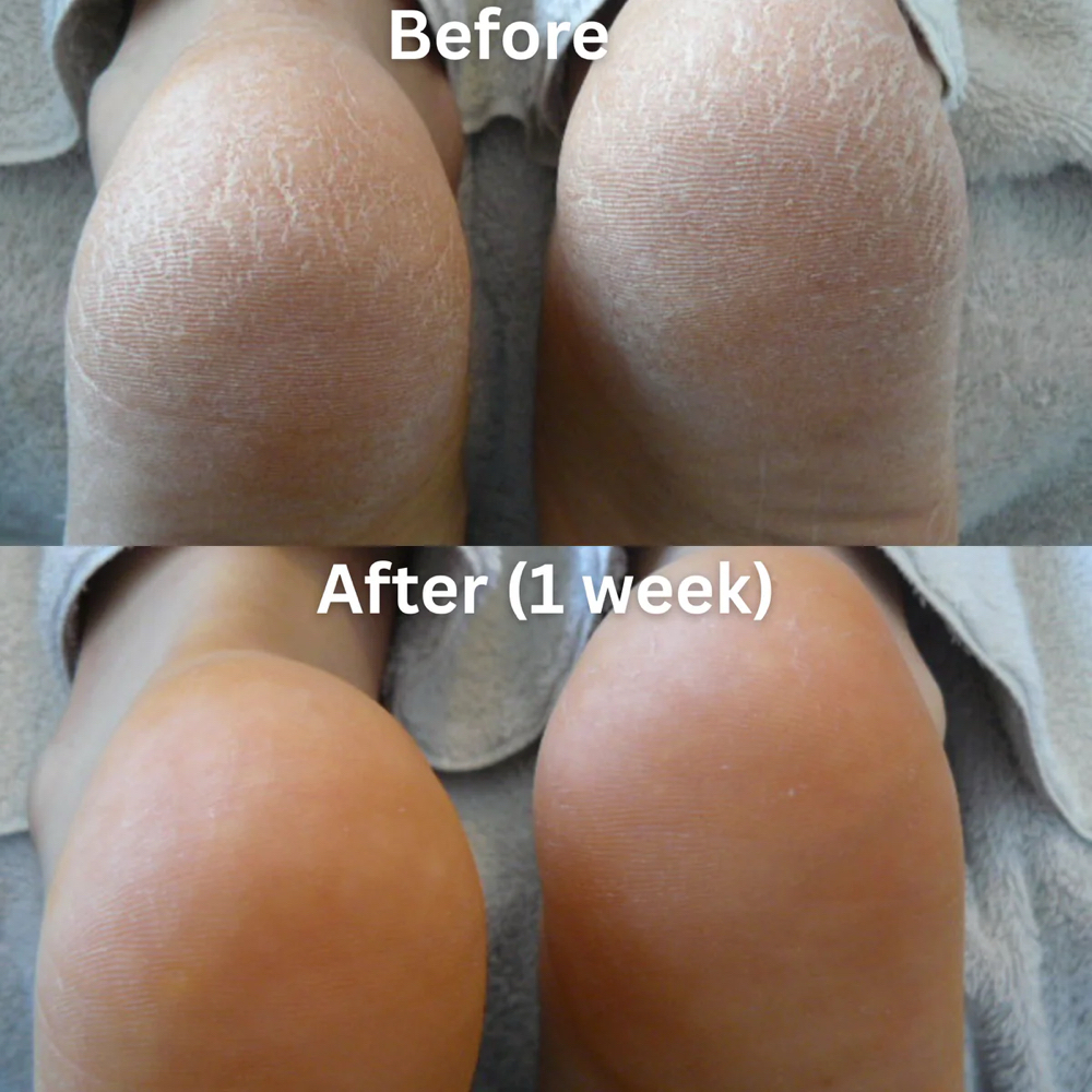 Deep Repair Pedicure at MNB SALONS LLC in San Antonio, TX