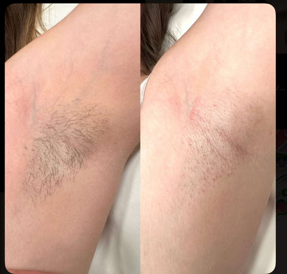 Under Arm Wax