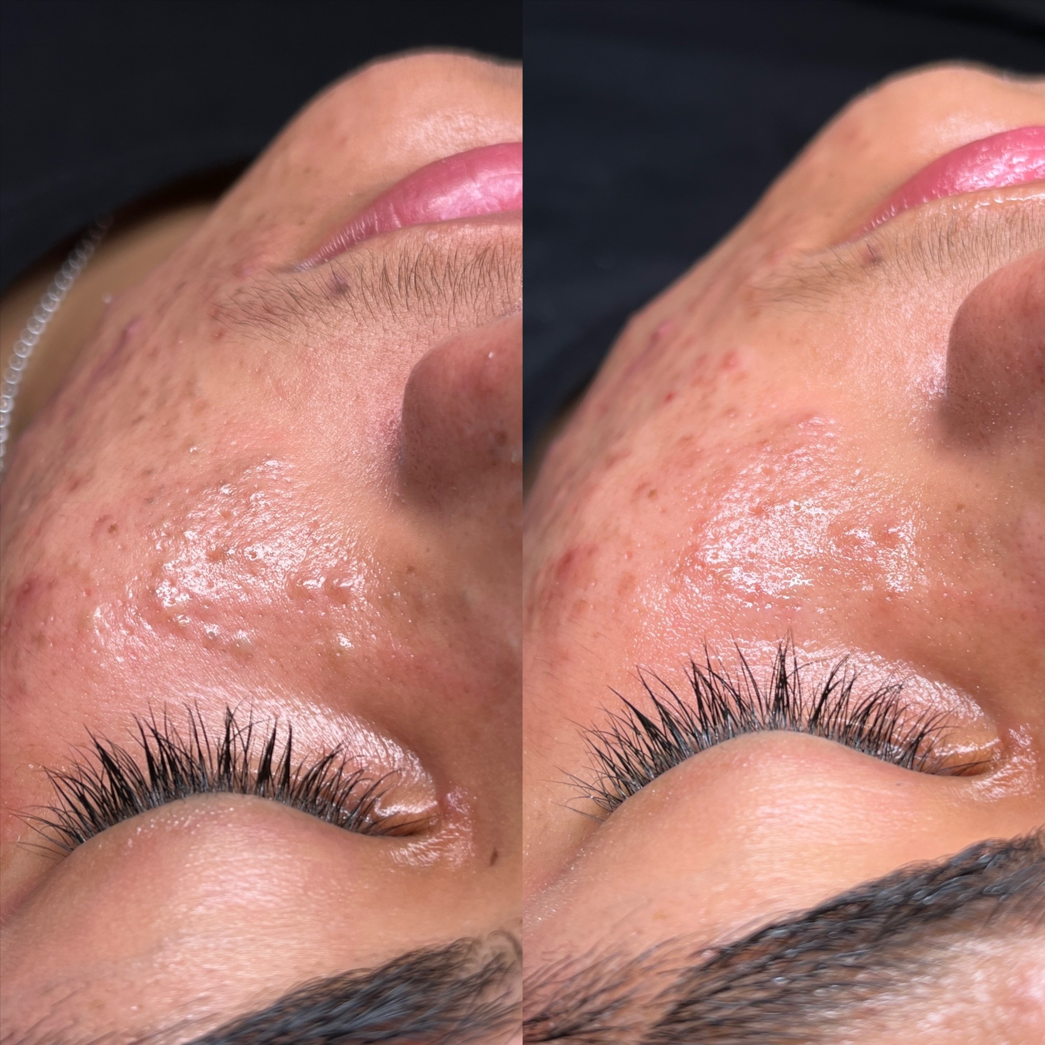 Love's Beauty Signature Facial at Love Beauty Lounge in Victorville, CA