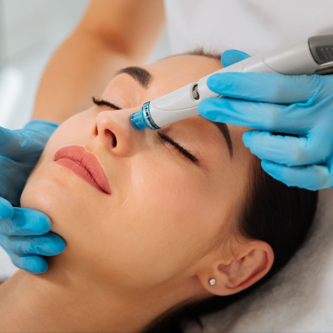 Hydro Facial + Mediderma Peel