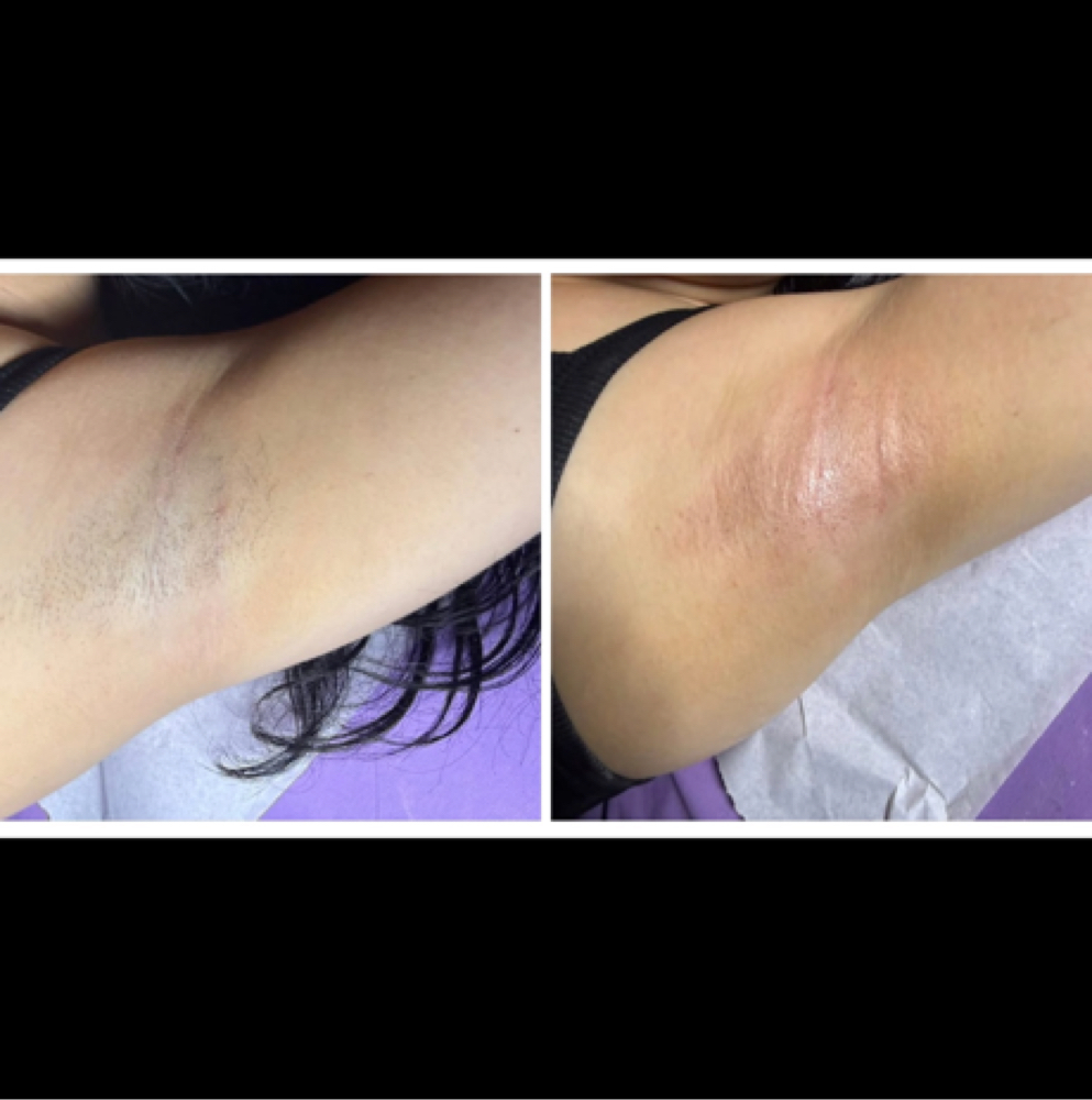 Underarm Wax at CWC Studio in Myrtle Beach, SC