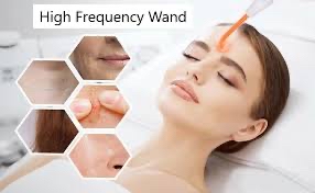 High Frequency Consultation