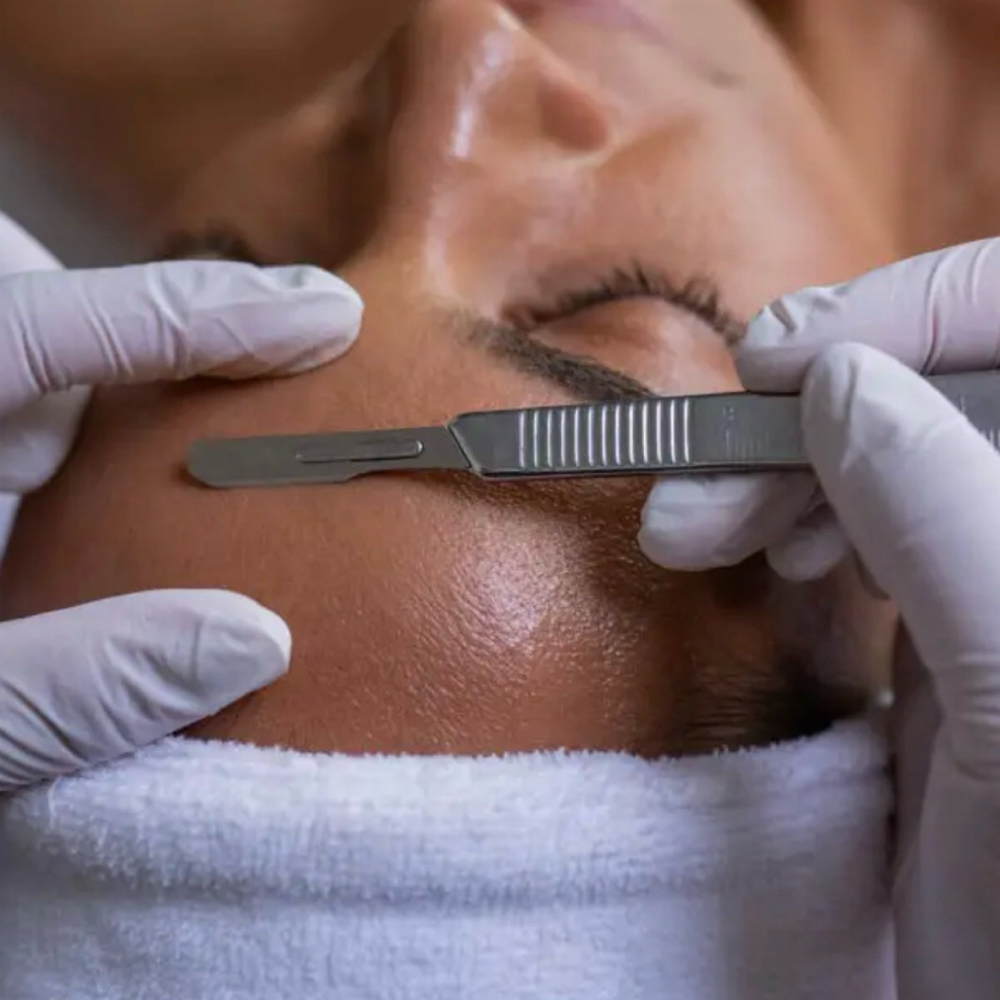 Dermaplane Facial Treatment at Ash Glow Aesthetics in Staten Island, NY
