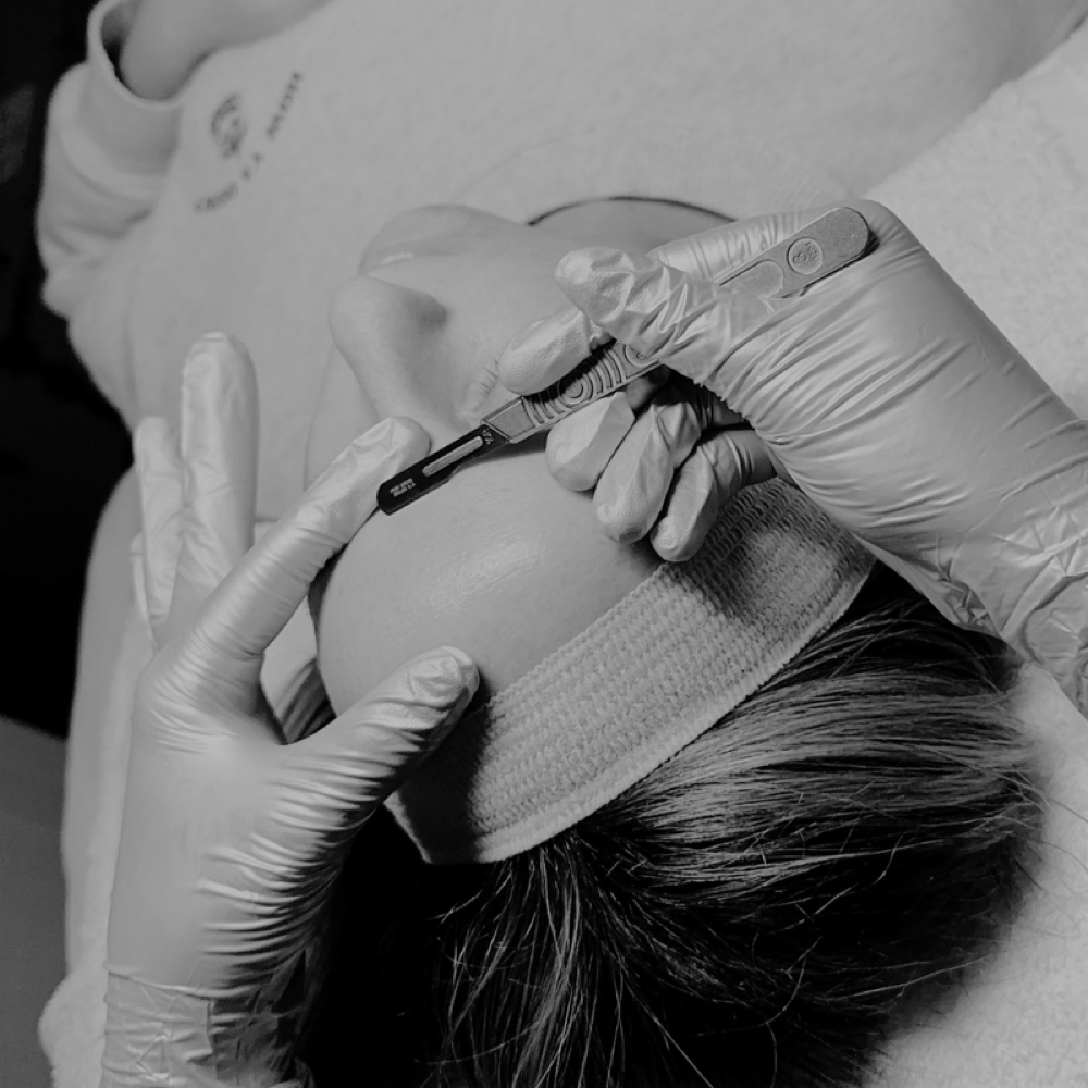 Dermaplane Facial at Bare Aesthetics By Chloe in Lake Norman of Catawba, NC