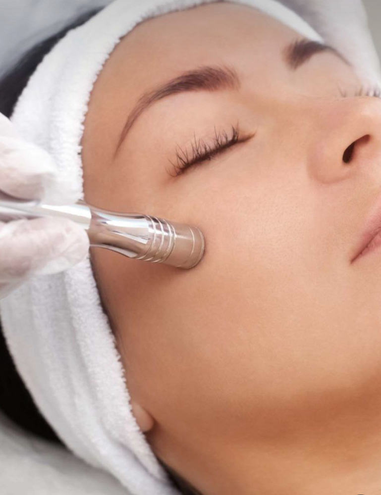 Microdermabrasion