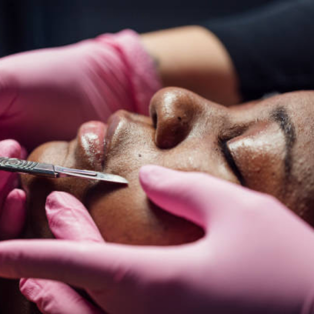 Dermaplane Glow Facial at VIP Wax Studio in Charlotte, NC