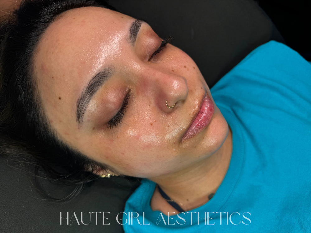 CUSTOM FACIAL